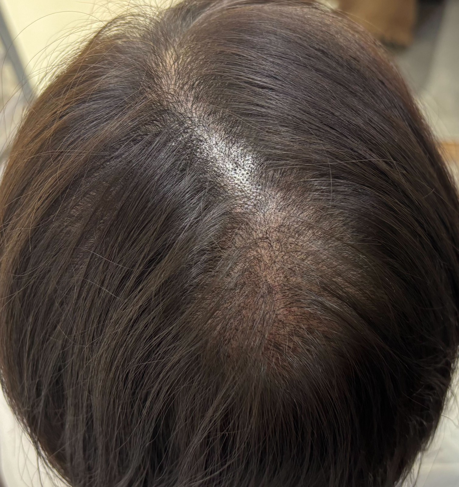The same parting after treatment