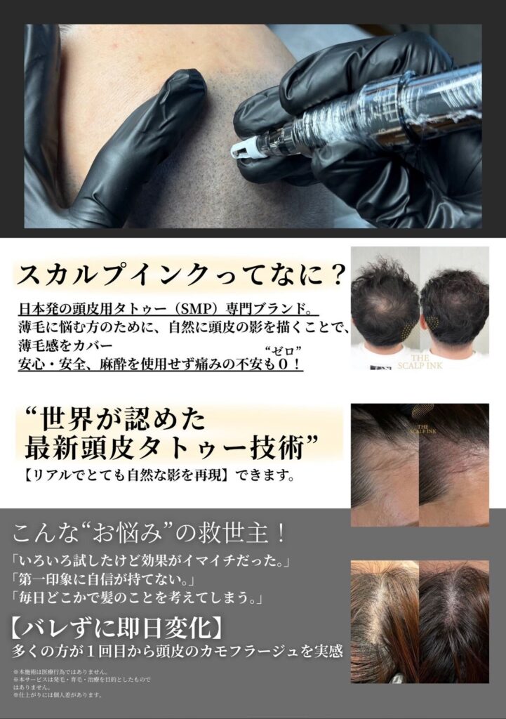 スカルプインクとは　薄毛　頭皮アートメイク